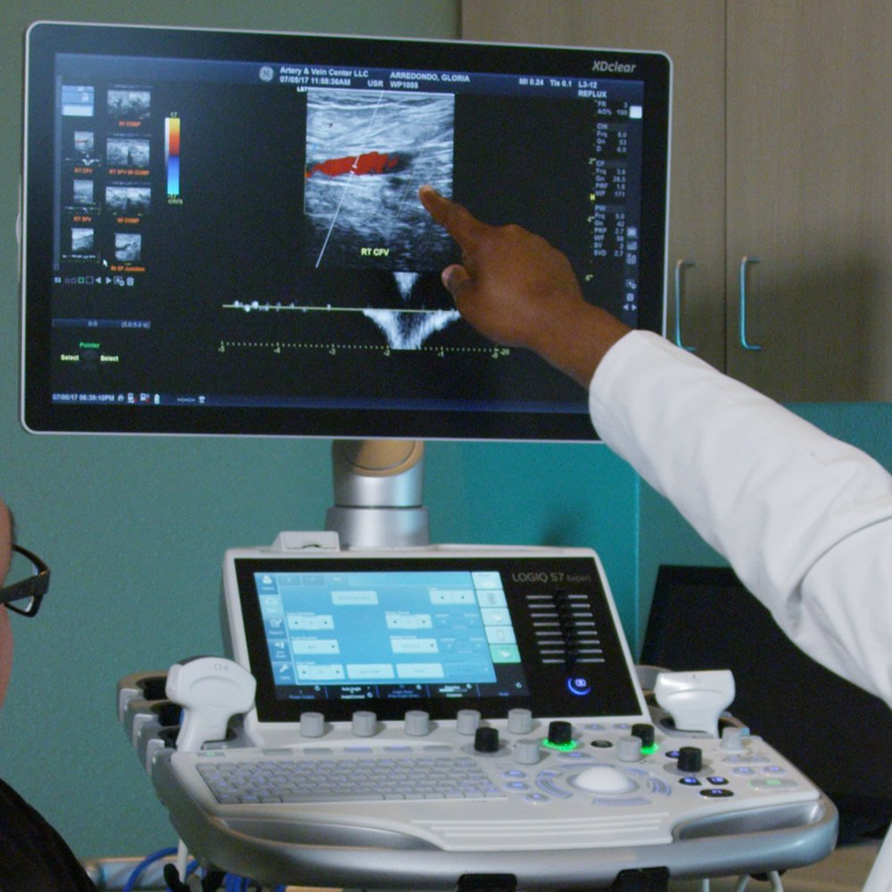 Vascular - Ultrasound